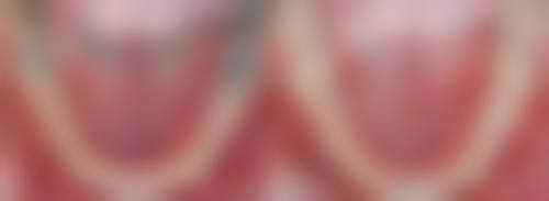 安吉爱齿口腔诊所口碑怎么样：患者的真实评价