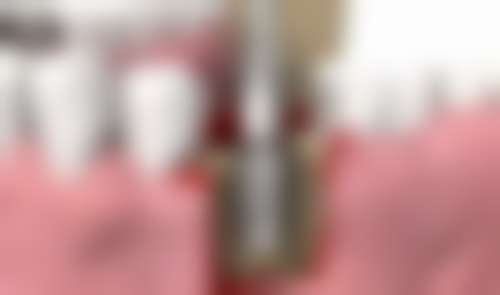 天津康齿美口腔门诊部真实实例