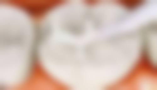 江苏南京江宁六贝口腔真实实例