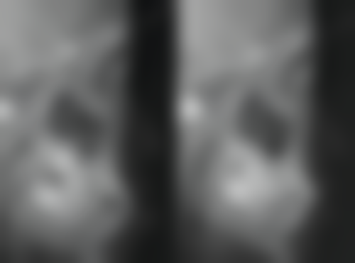 景先平医生口碑评价:患者的一致好评