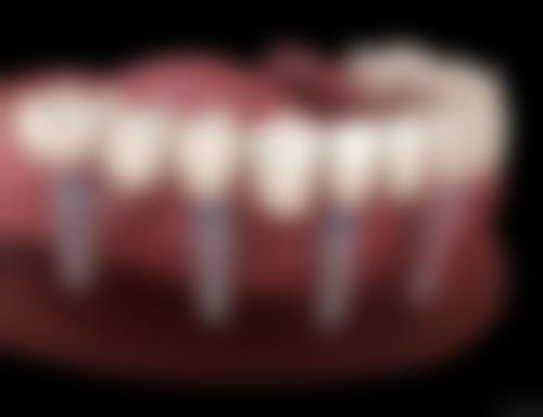 北京朝阳赛德阳光口腔(三元桥总店)真实实例