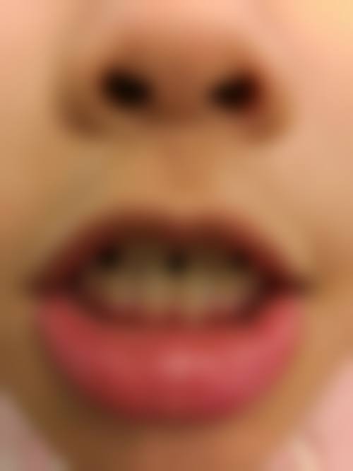 江苏淮安美齿口腔地址及乘车路线