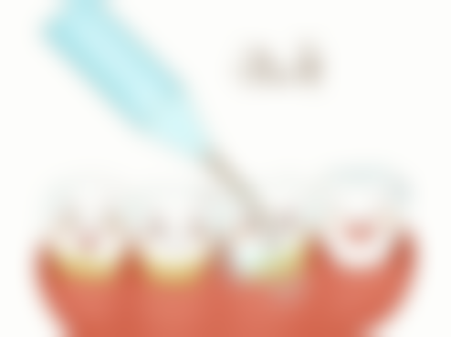 江苏淮安美齿口腔擅长项目