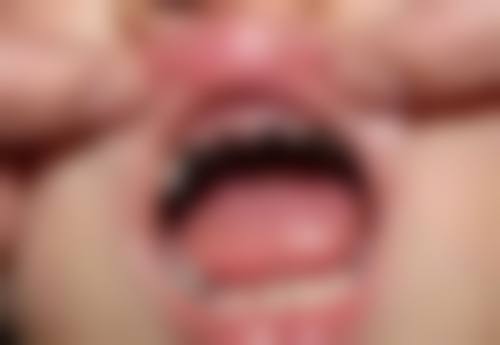 河南南阳方城万超口腔诊所许卓的正畸技术靠谱吗？