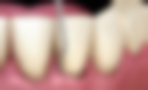 河南南阳方城万超口腔诊所许卓的种植牙技术怎么样？