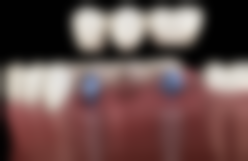 包头欣现代口腔医院电话号码