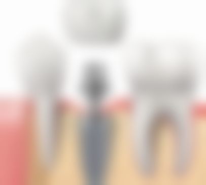 盐城市建湖荀氏口腔真实实例