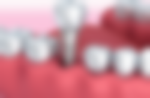 山东菏泽欧诺口腔门诊部擅长项目