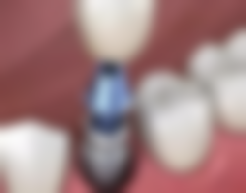 深圳友睦口腔（兴茂口腔门诊部）价格表