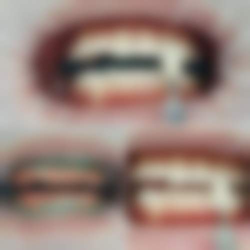 深圳御齿口腔门诊部价格表