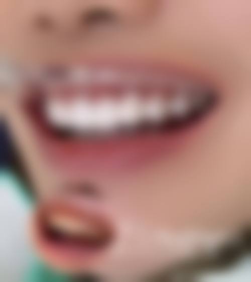 天水博仁口腔诊所仪器设备