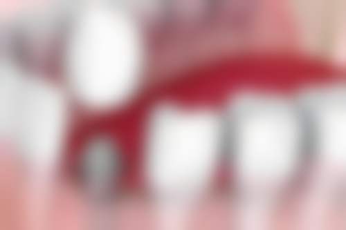 江西 南昌爱贝思口腔真实实例