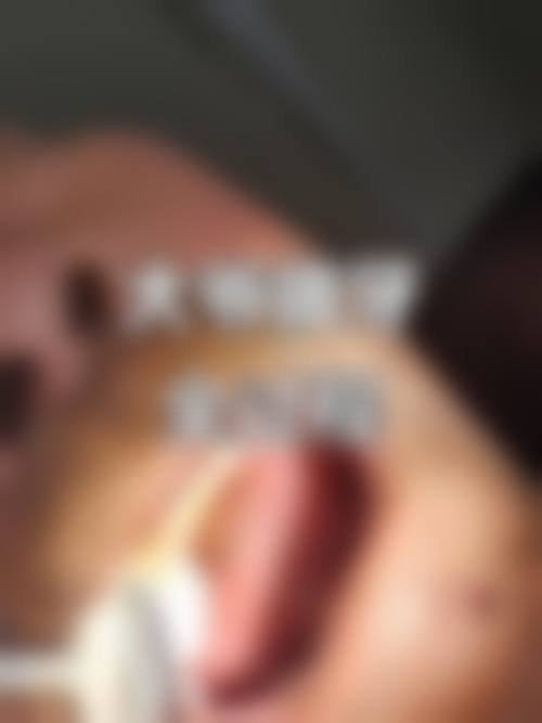 江苏徐州惠雅口腔门诊部擅长项目