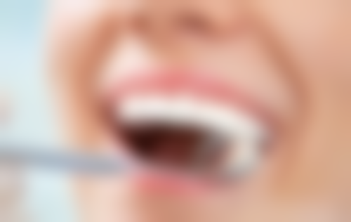 银汞合金材料补牙洞的坚固程度如何