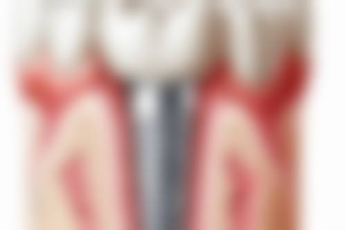 天津市黄河医院口腔科口碑怎么样