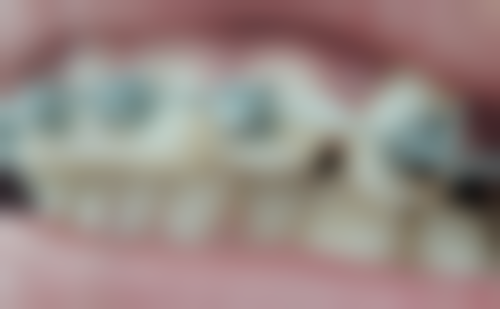 彭文和医生技术特点