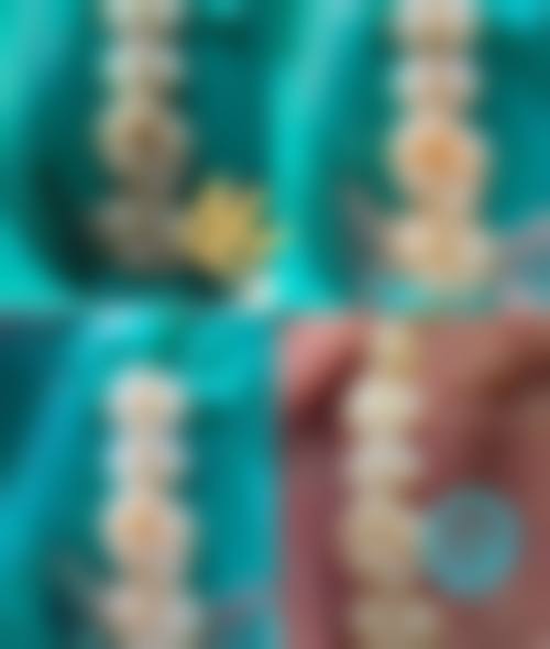 深圳诚致雅口腔诊所价格表