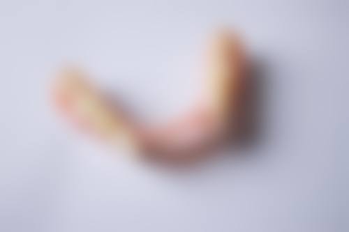 岳阳蒋志韬口腔诊所真实实例：见证牙齿的华丽变身