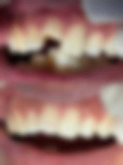 渭南市唯尔美口腔门诊部价格表