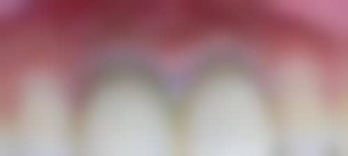 浙江宁波宁海丁伟口腔诊所仪器设备：精良科技助力治疗