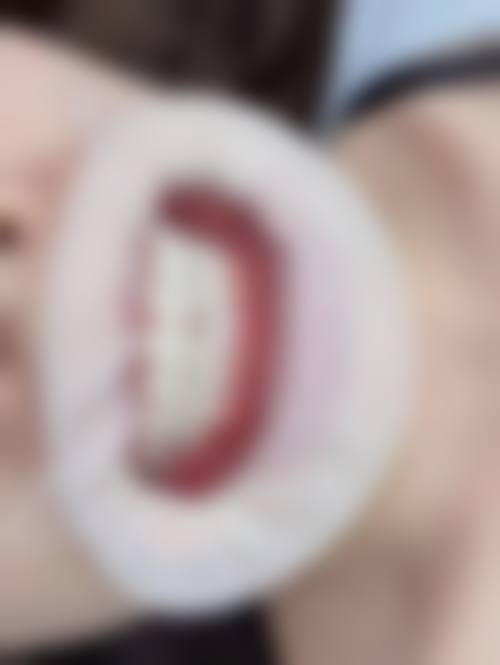 惠州天使口腔门诊部价格表：透明合理