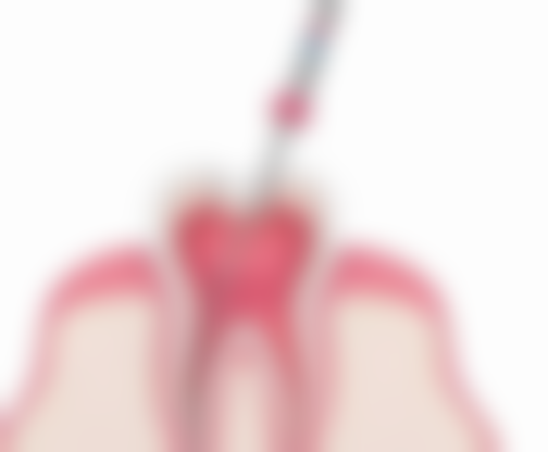 余新羽医生真实实例