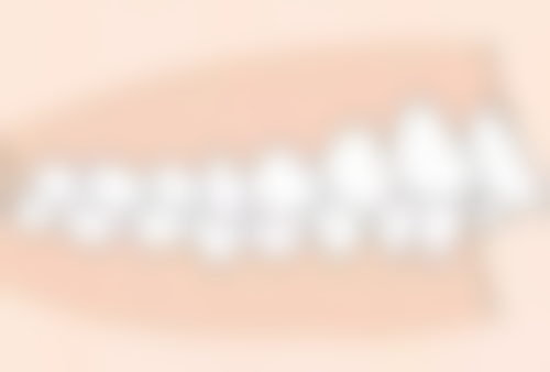 内分泌失调可以拔牙吗？专家揭秘：内分泌失调拔牙的风险与注意事项，为你的口腔健康保驾护航！ 