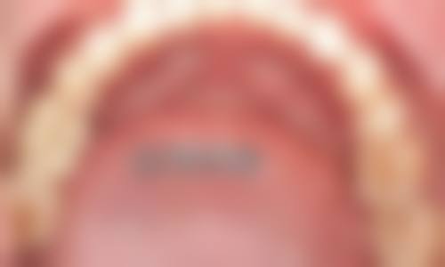 杭州张忠良口腔诊所真实实例