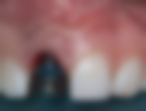 广州黄埔杨晓冰口腔仪器设备