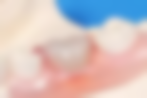 中山亮美口腔门诊部预约挂号方式：便捷效率高的就诊途径