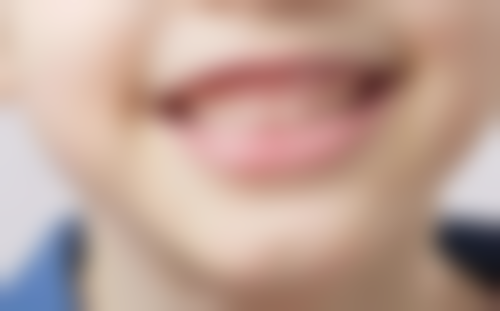 做过根管治疗的牙齿寿命有多久？揭秘影响因素，多数情况下精心护理可使用10 - 20年！ 