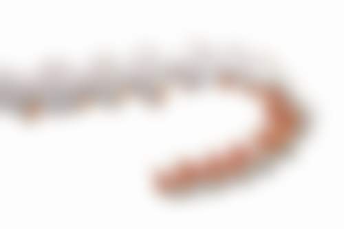 深圳海伦口腔诊所海德店真实实例：成效看得见