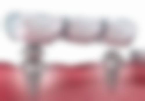 廊坊燕郊晶颜（原阳光树）口腔价格表：透明合理超划算