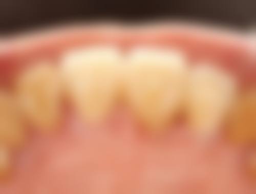 南昌澳齿红角洲口腔门诊部真实实例