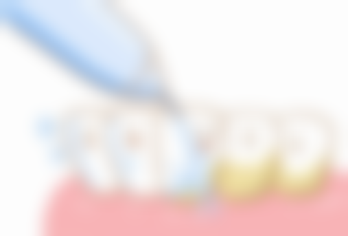 广西防城港防城齿康口腔预约挂号方式