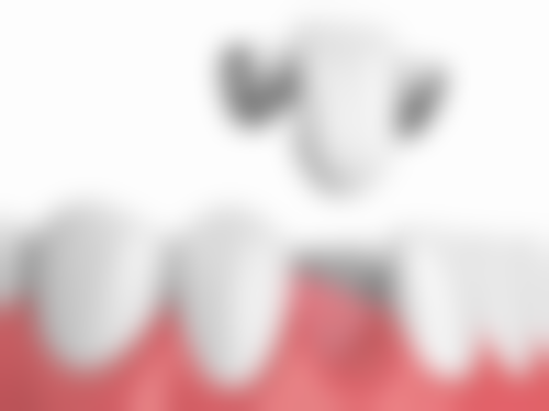 山东第一医 科 大学第二附属医院任飞飞医生真实实例