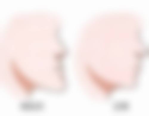 润玺口腔门诊部真实实例