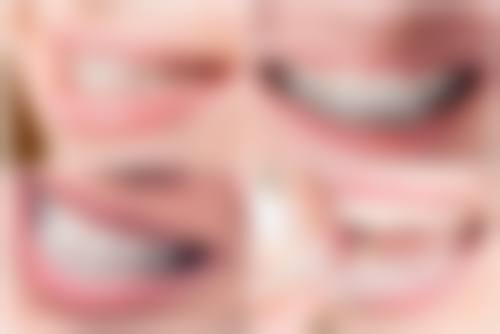 体积小的活动义齿使用寿命长吗