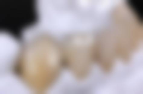 广东东莞麦芽口腔价格表