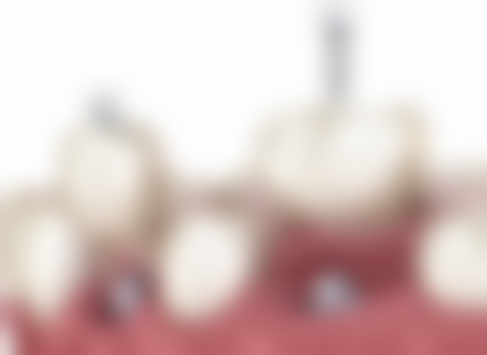 徐素英医生真实实例