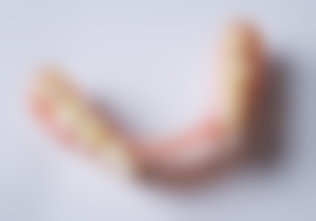 体积小的活动义齿适合哪些人群