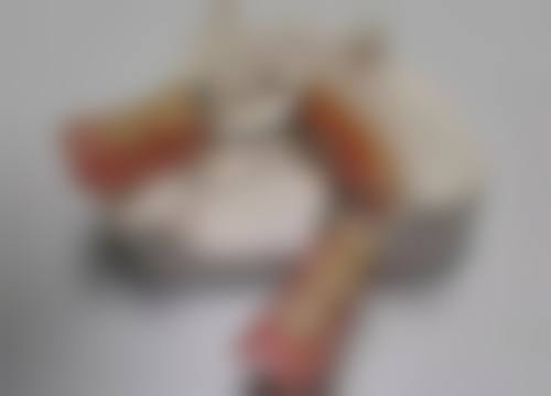 牙齿矫正1 - 2个月的初步变化怎么样