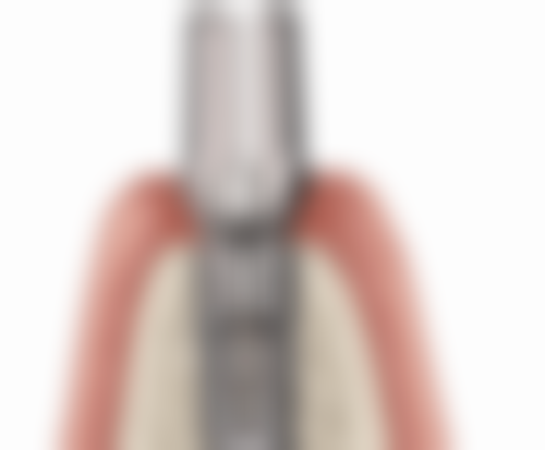 陈瑶医生口碑评价：患者的一致好评