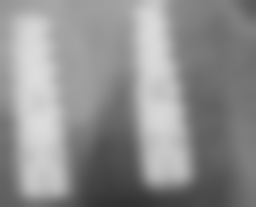 深圳青苗儿童口腔（悦和店）口碑怎么样