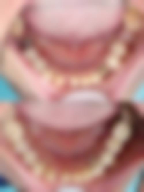 台州温岭城东健雅口腔口碑怎么样