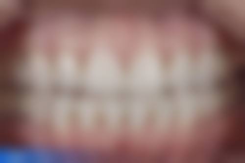 山东邹平曲蒙蒙口腔诊所擅长项目