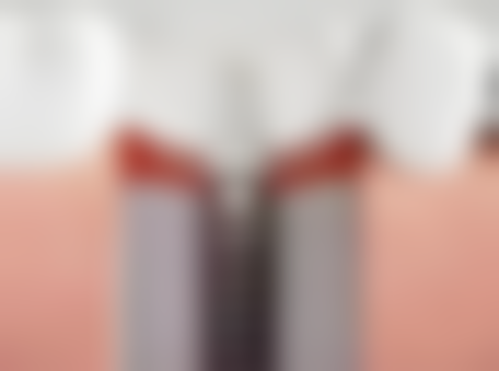 拔牙后多久可以补牙