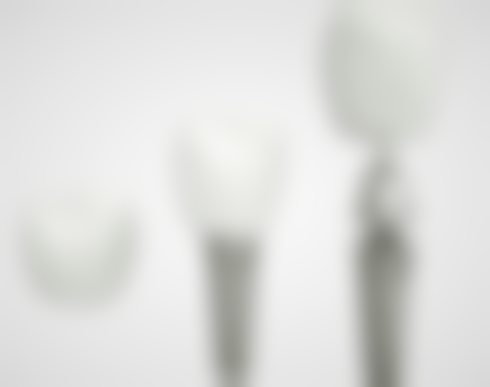 补牙寿命受哪些因素影响