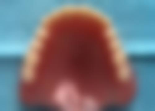 拔牙一周后牙龈肿痛适合看哪个科室