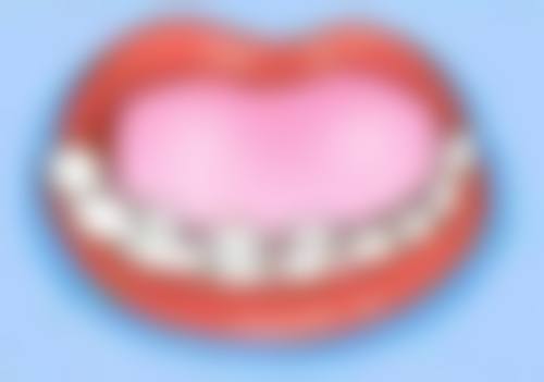 全瓷牙价格2000 - 8000元值不值